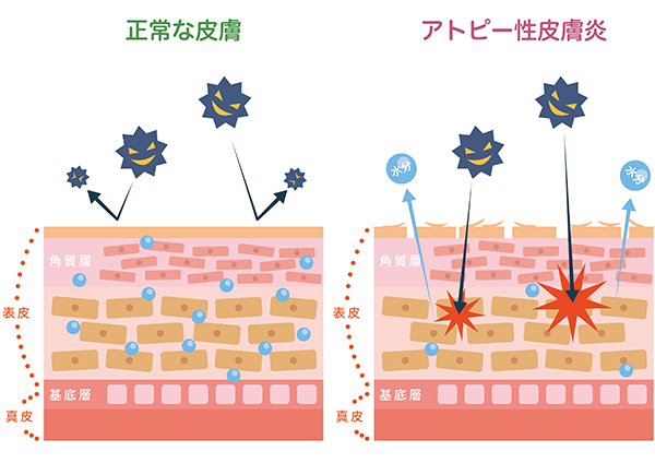 目眩（めまい）とは